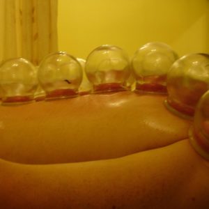 cupping-gesund
