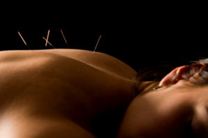 gesund-Acupuncture